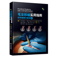 毛发移植实用指南：初学者操作指导（上）