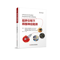 超声引导下周围神经阻滞