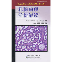 乳腺病理活检解读