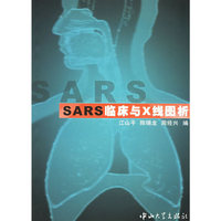 SARS临床与X线图析