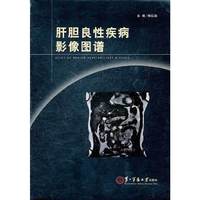 肝胆良性疾病影像图谱