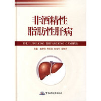 非酒精性脂肪性肝病