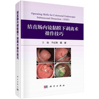 结直肠内镜黏膜下剥离术操作技巧