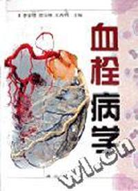 血栓病学