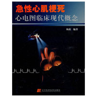 急性心肌梗死心电图临床现代概念