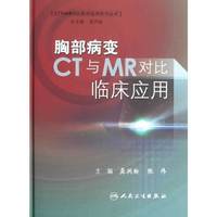胸部病变CT与MR对比临床应用