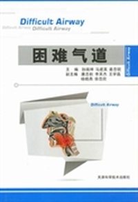 困难气道