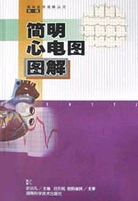 简明心电图图解
