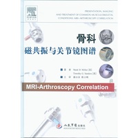 骨科磁共振以关节镜图谱
