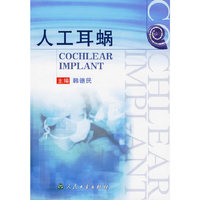 人工耳蜗