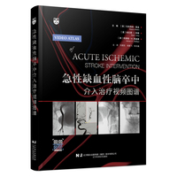 急性缺血性脑卒中介入治疗视频图谱