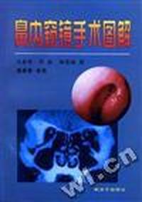鼻内窥镜手术图解