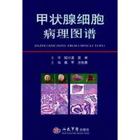 甲状腺细胞病理图谱