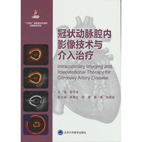 冠状动脉腔内影像技术与介入治疗