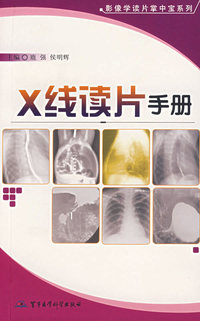 X线读片手册