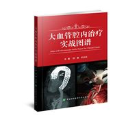 大血管腔内治疗实战图谱