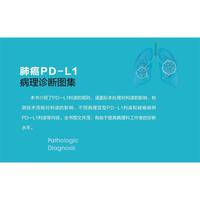 肺癌PD-L1病理诊断图集