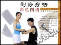 刮痧疗法彩色图谱