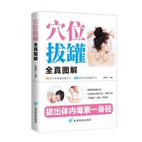 穴位拔罐全真图解