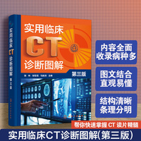 实用临床CT诊断图解（第三版）