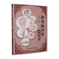 神奇的针灸 家庭保健