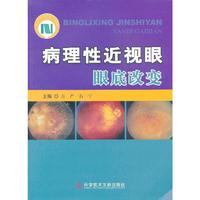 病理性近视眼眼底改变