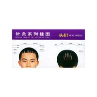 头针/针灸系列挂图