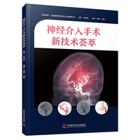 神经介入手术新技术荟萃