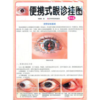 便携式眼诊挂图