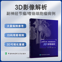 副神经节瘤/嗜铬细胞瘤病例3D影像解析