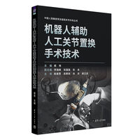 机器人辅助人工关节置换手术技术