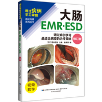 大肠EMR·ESD