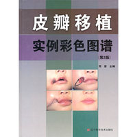 皮瓣移植实例彩色图谱（第2版）