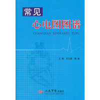 常见心电图图谱