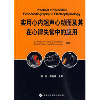 实用心内超声心动图及其在心律失常中的应用