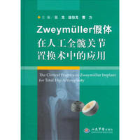 Zweymüller假体在人工全髋关节置换术中的应用