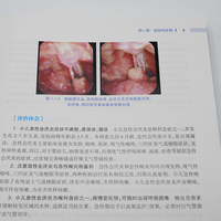 小儿呼吸系统疑难重症病例解析