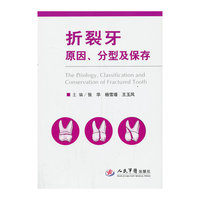 折裂牙原因.分型及保存