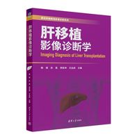 肝移植影像诊断学