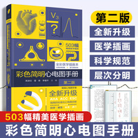彩色简明心电图手册（第二版）