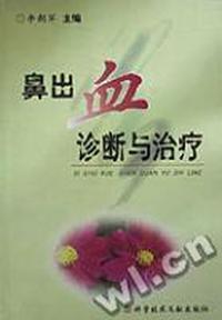 鼻出血诊断与治疗