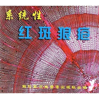 系统性红斑狼疮（VCD）