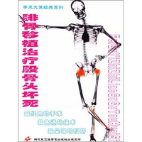 腓骨移植治疗股骨头坏死（VCD）