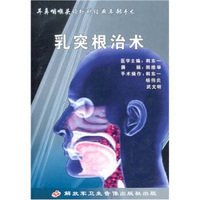 乳突根治术（VCD）