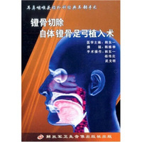 镫骨切除自体镫骨足弓植入术（VCD）