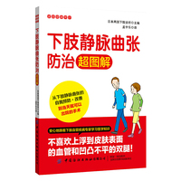 下肢静脉曲张防治超图解