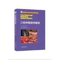 口腔种植案例解析