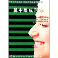 鼻中隔成形术 （VCD）