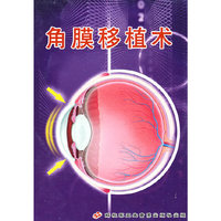 角膜移植术（VCD）