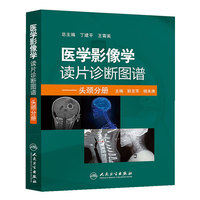 医学影像学读片诊断图谱-头颈分册